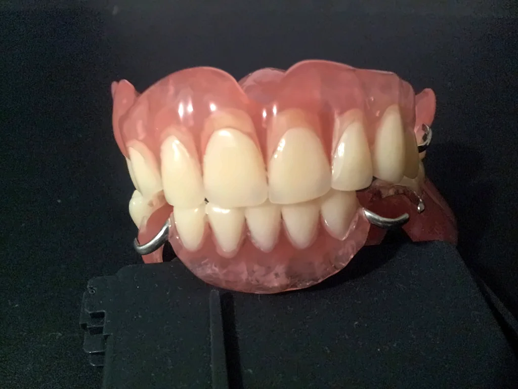 Prótesis dental con ganchos para sujetarse a los dientes